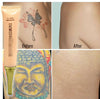 Tattoo Removal Cream