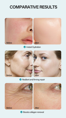 Anti-Wrinkle Face Cream Containing Hyaluronic Acid Hydrating High Moisturizing Fade French