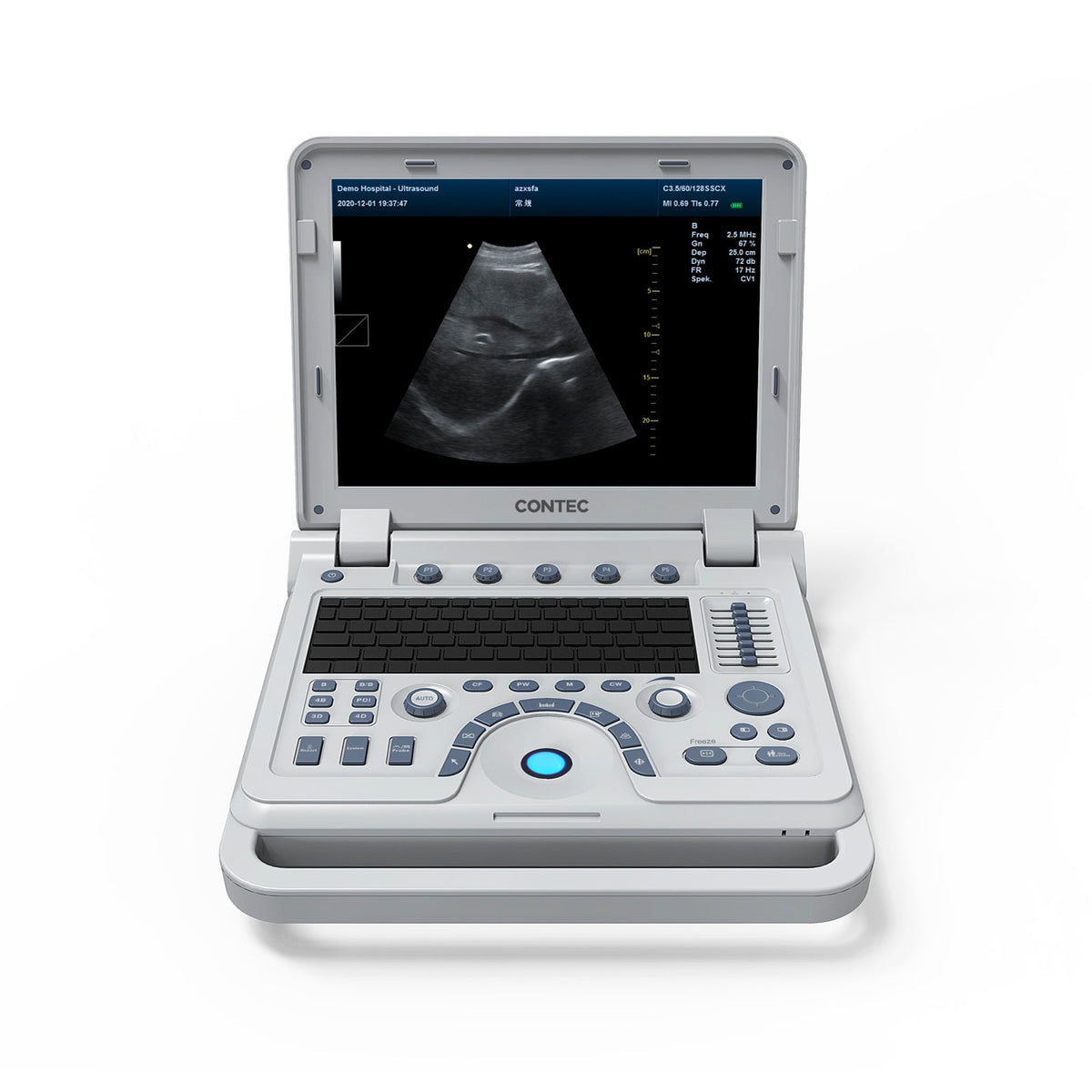 Animal Scan Computer VET Veterinary Portable Ultrasound Scanner Laptop Machine Color Doppler ...