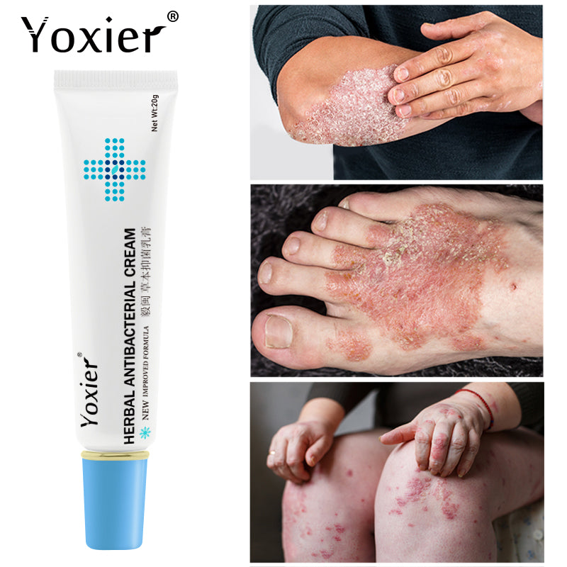 Oam Rash Cream Herbal Antibacterial Cream Psoriasis Cream Anti-itch Relief Eczema Skin ...