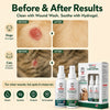 PetVet Medic® 2-Step Wound HOCL Care System for Pets – Wound Wash + Hydrogel